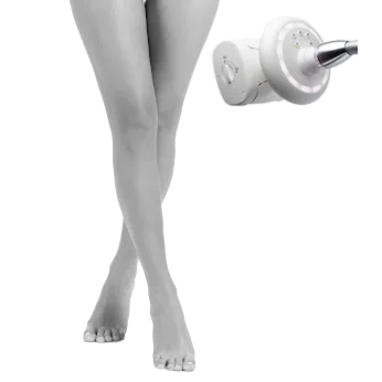 Endermologie Heavy Legs Hesmida Treatment Kent